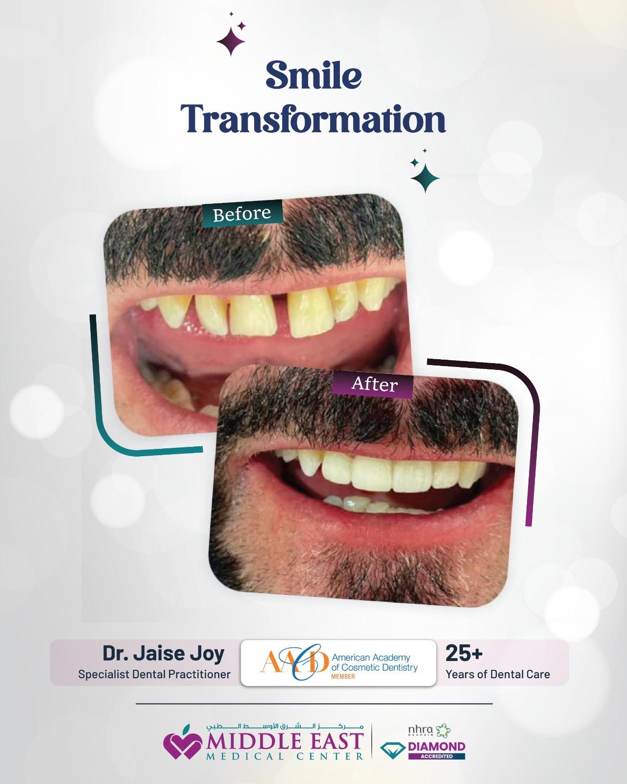 Stunning smile result